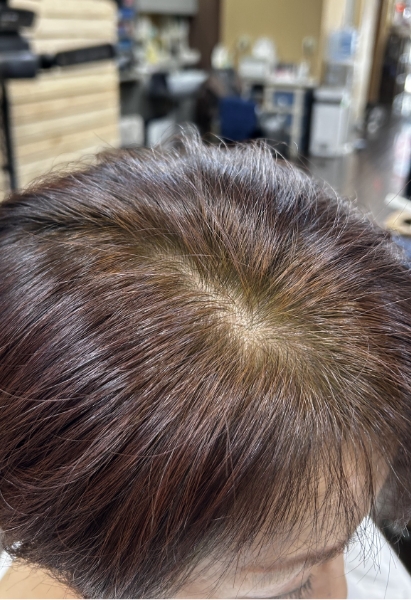 AFTER